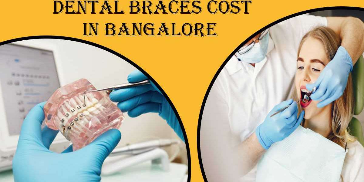 Best Dentist for Braces in Bangalore | Best Dental Clinic